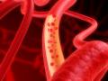 das Bild zu 'blood vessel' auf Deutsch