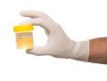 das Bild zu 'urine test' auf Deutsch