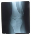 das Bild zu 'X-ray' auf Deutsch